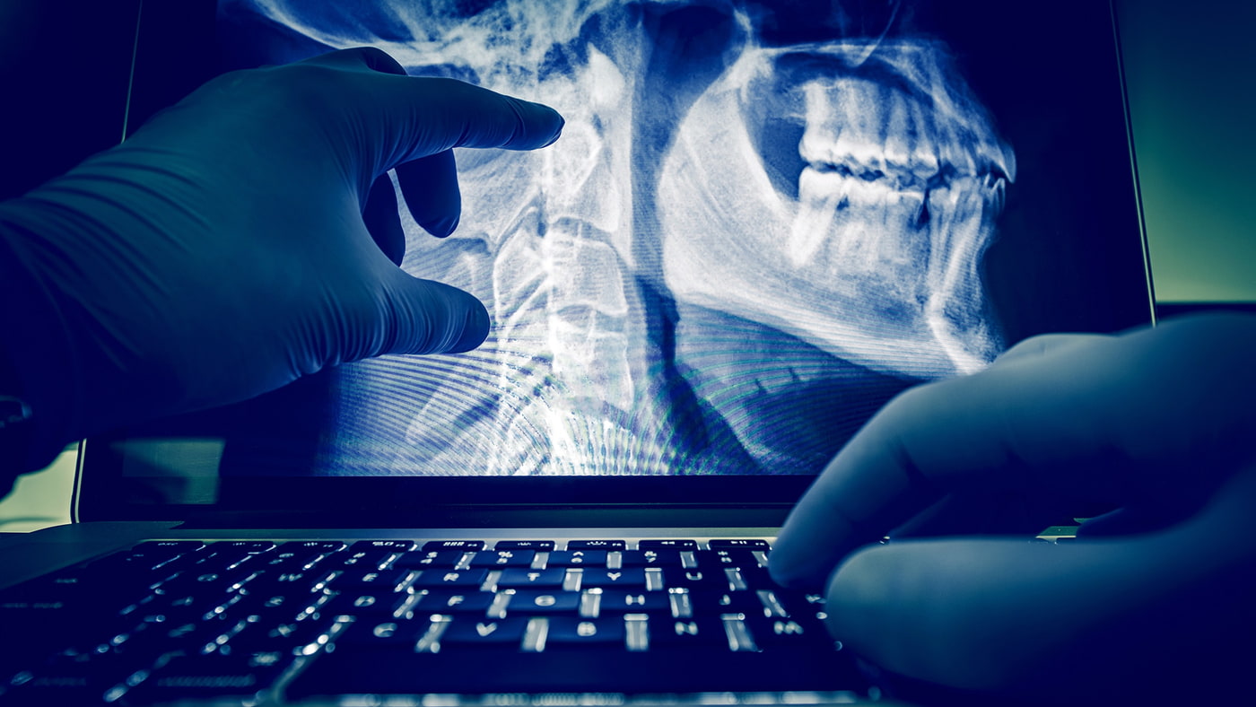 Röntgenbild mit Kiefer auf geöffnetem Laptop